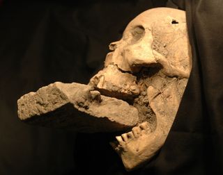 The skull of the "vampire of Venice," found in a mass grave with a brick stuck in its jaw.