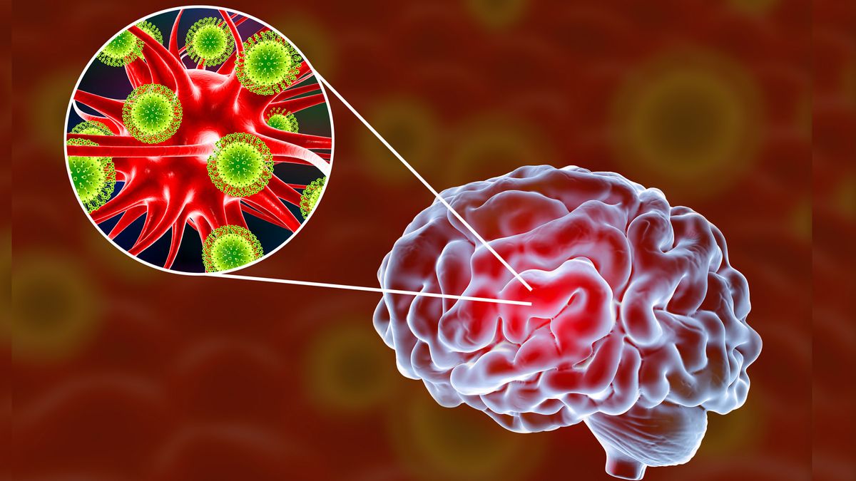 Virus attacking brain and brain cells.