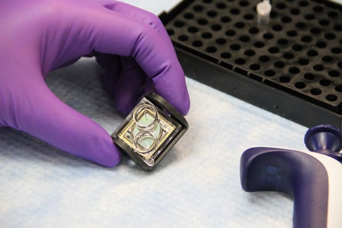 diagnostic chip can quickly determine best medicine