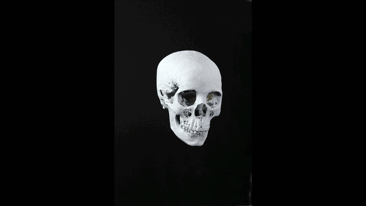 Forensic facial reconstruction.