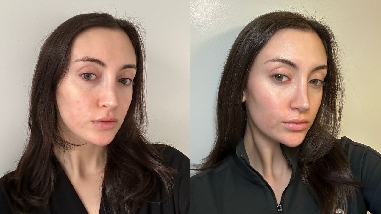 Alyssa Brascia before and after testing the Trinny London Energise Me Moisturizer.