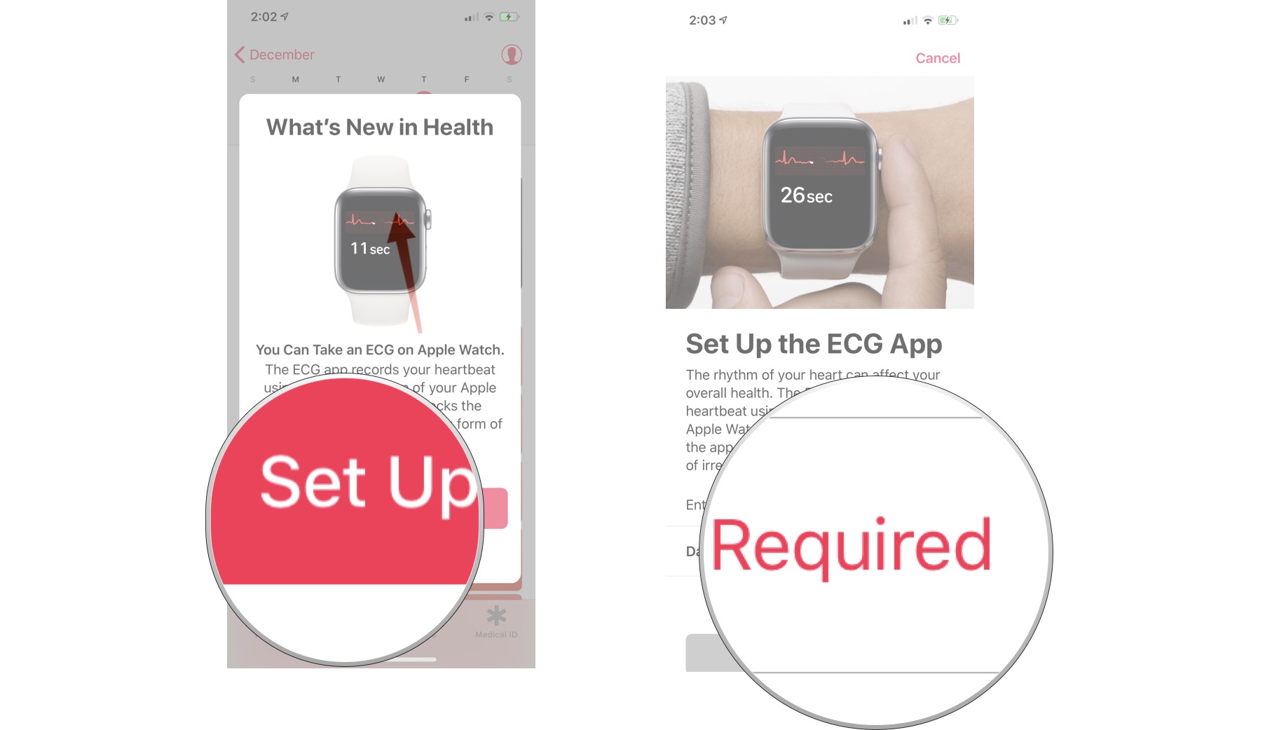 ECG Apple Watch App: The Ultimate Guide | iMore