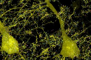 This image, taken from a mouse brain, shows neurons (yellow) and proteins involved in their synapses (cyan and magenta).