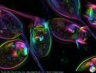 live vorticella organisms under microscope