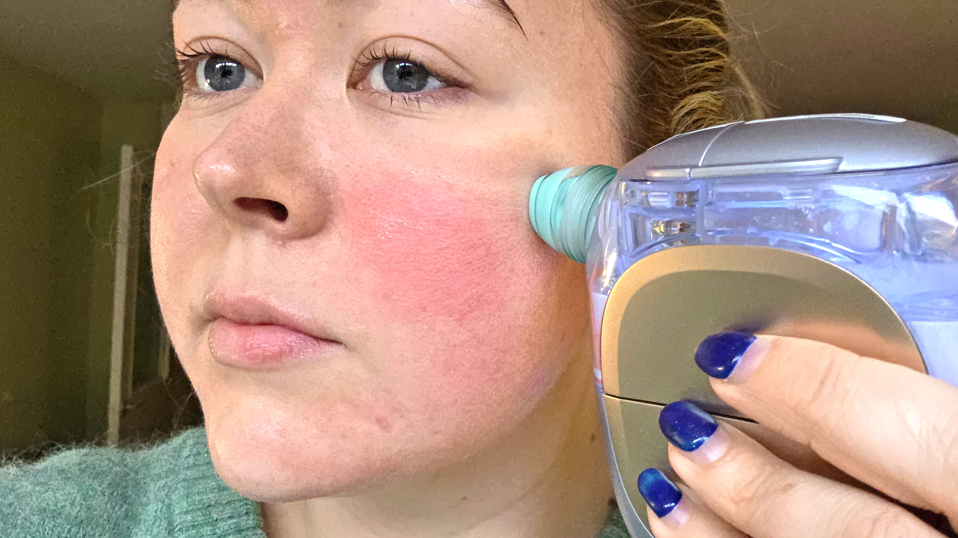 Shark FacialPro Glow