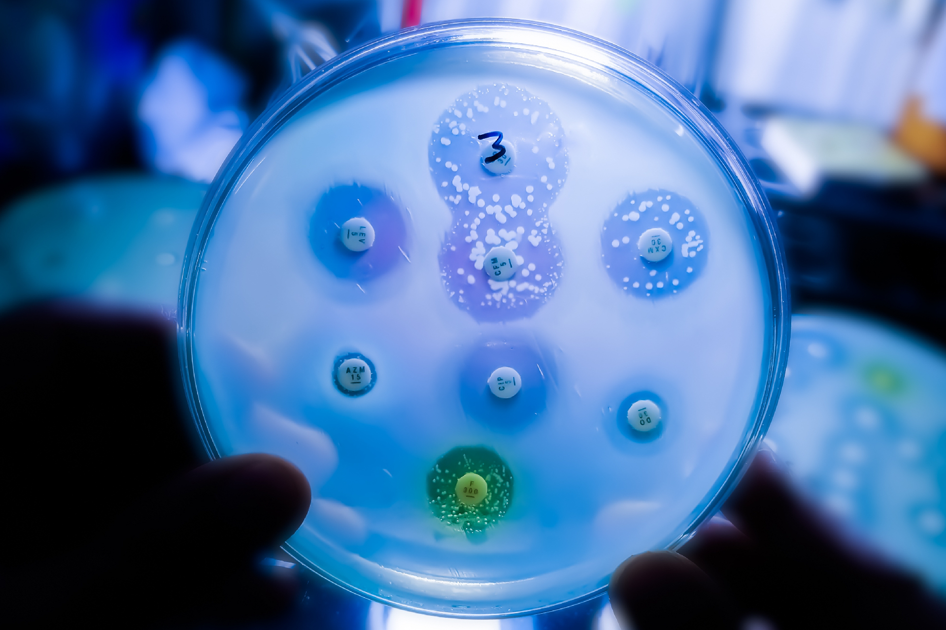 Een foto van een agarplaat waarop een microbioloog de antibioticaresistentie van bacteriën controleert.