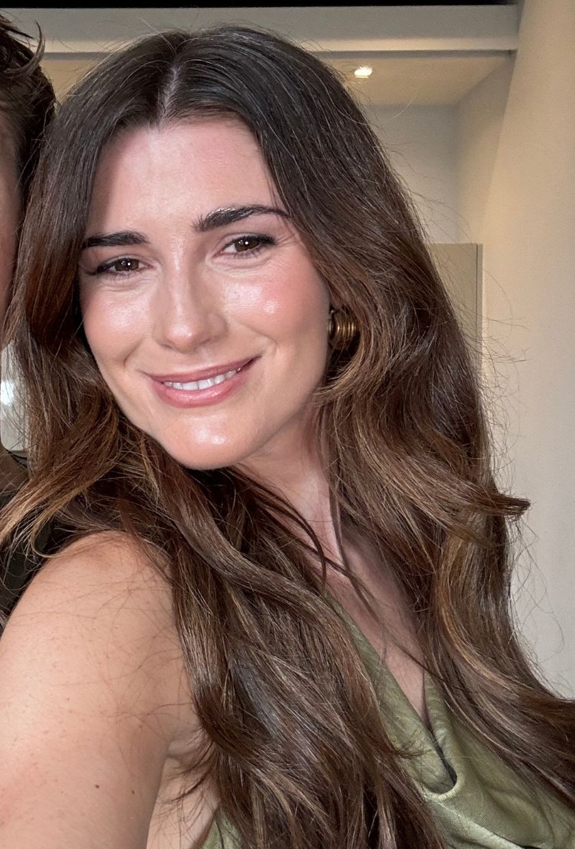A photo of Eleanor before her Botox brow lift