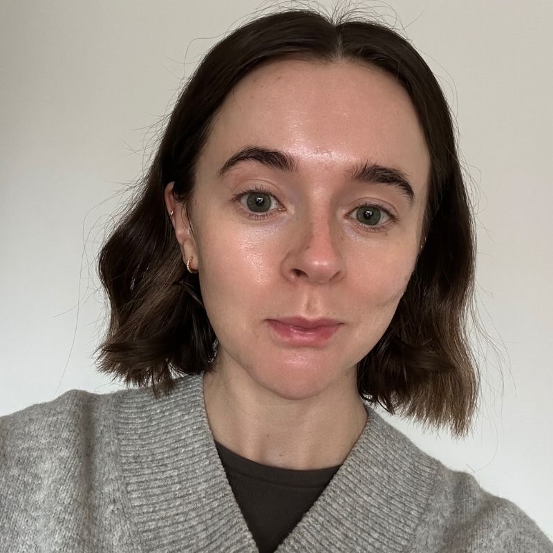 Grace Day Before applying Tatcha&#039;s The Kissu Lip Mask