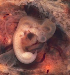 The human embryo at week 5.