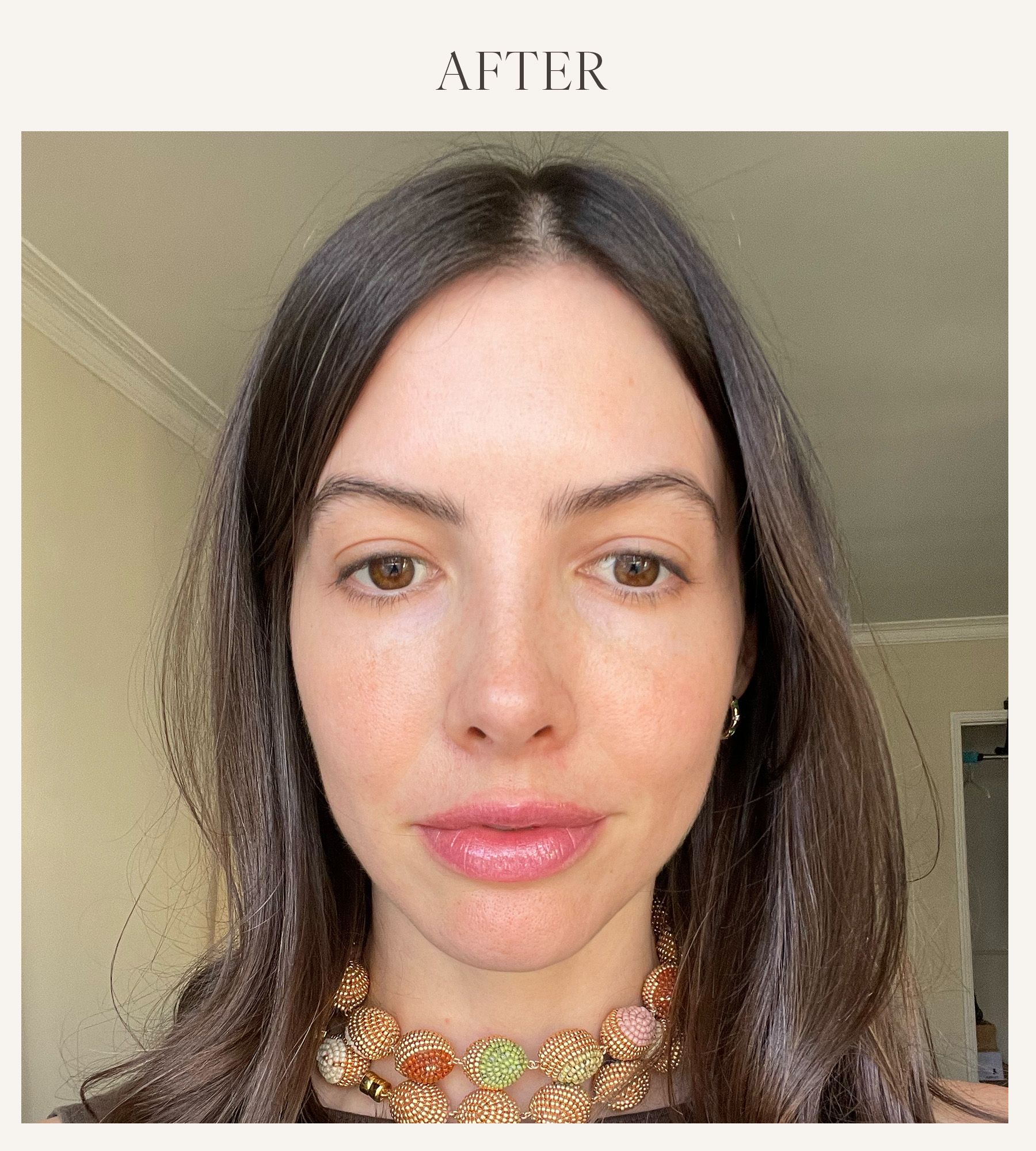 After photo of Kat Collings testing the Too Faced lip plumper