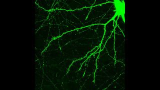 Neuronal spines shown in a green image of a neuron.