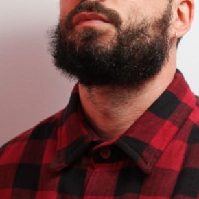 The patchy-bearded hipsters who get facial-hair transplants