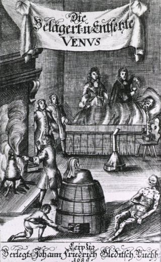A woodcut from 1689 showing various methods of syphilis treatment including mercury fumigation.