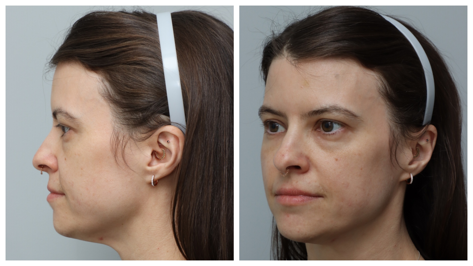 two images side by side of a white woman with brown eyes and brown hair