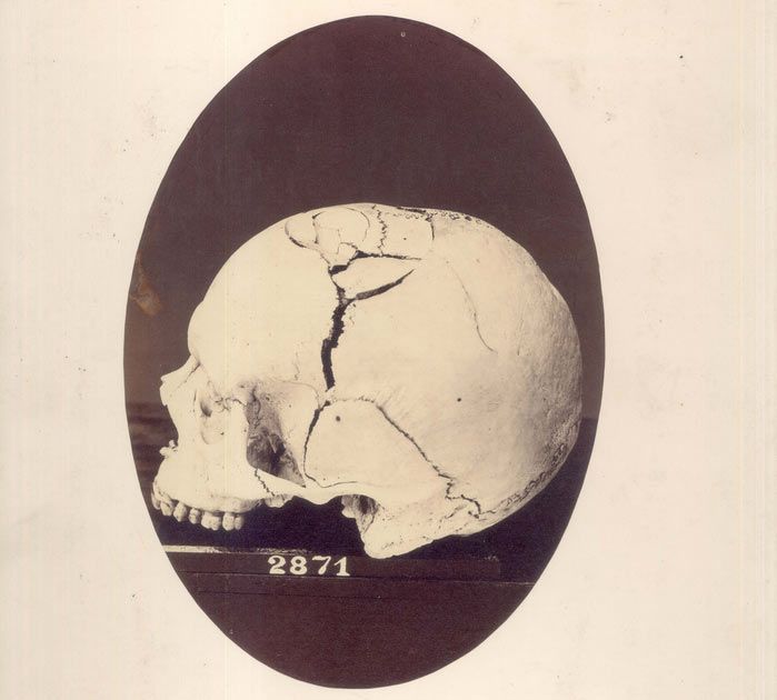 Album Faces and Injuries of the Civil War Live Science