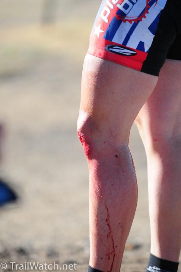 Katie Compton crashed after some blowing course tape caught on her handlebars, resulting in multiple cuts