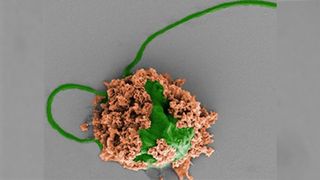 Colored SEM image of a pneumonia-fighting microrobot made of an algae cell (green) covered with biodegradable polymer nanoparticles (brown).