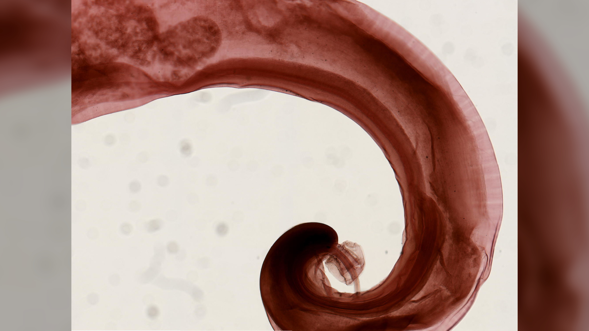 A picture of the parasitic worm that causes trichuriasis.