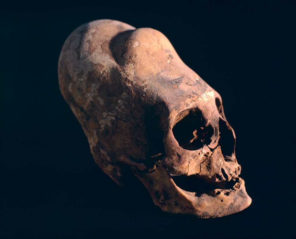 A photograph of a brown human skull in front of a black background, its forehead long and conical as it's been shaped to be flatter and taller