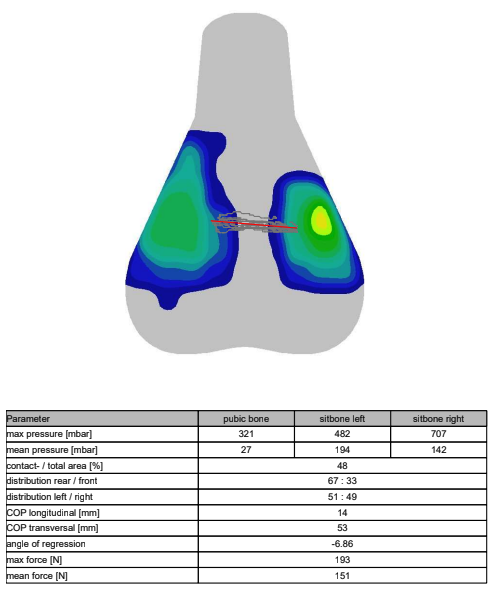 A visual output of saddle pressure mapping