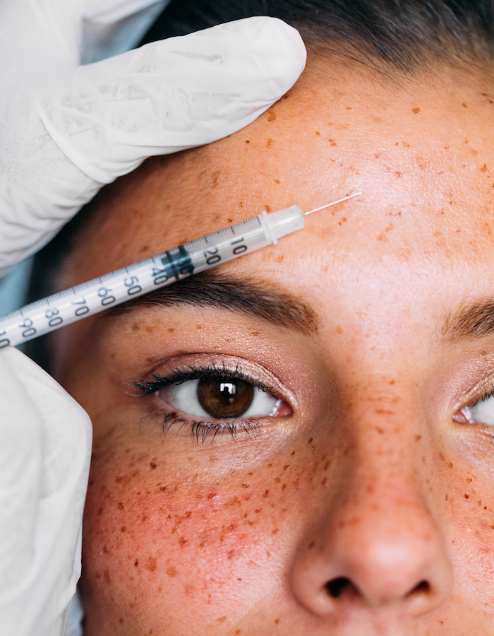 Woman getting filler injected into her forehead