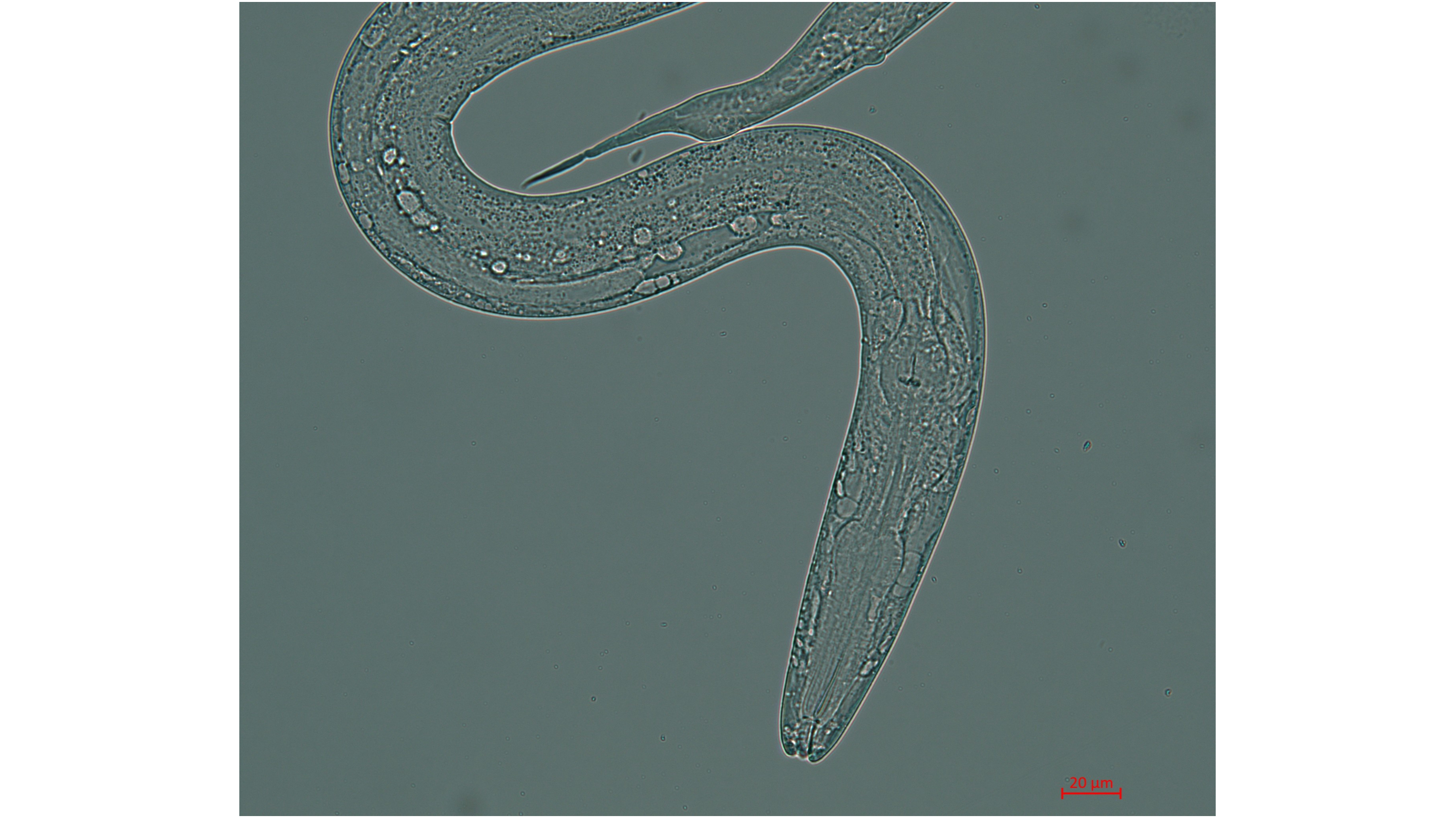 microscope image of a small, transparent roundworm