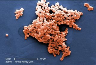 An image of Streptococcus bacteria