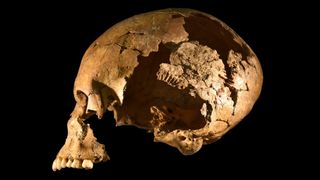 A skull of a young boy who died in early medieval Germany. 