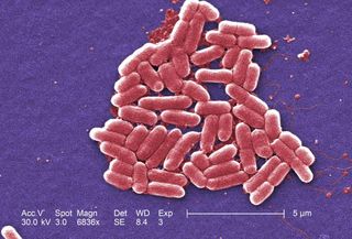 Colorized scanning electron micrograph depicting Escherichia coli bacteria, which recent research shows can breed in gravity 400,000 times stronger than that of Earth. Most E. coli strains are harmless, but the one here is O157:H7, which can cause severe 