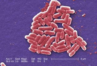 Colorized scanning electron micrograph depicting Escherichia coli bacteria, which recent research shows can breed in gravity 400,000 times stronger than that of Earth. Most E. coli strains are harmless, but the one here is O157:H7, which can cause severe