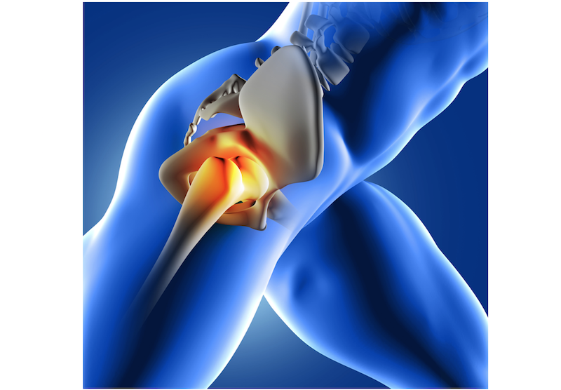 Stem Cells Could Replace Hip Replacements Live Science