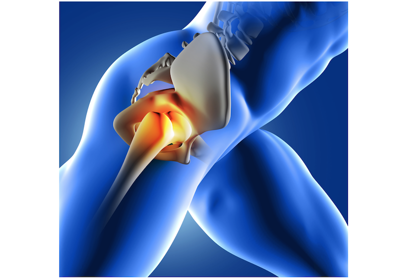 A diagram of the human hip joint