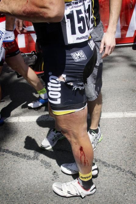 Maarten Tjallingii ended up with a few scrapes