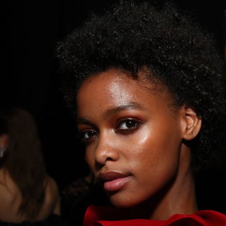 model with acne 