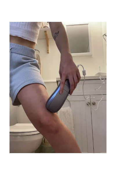 Senior Culture Editor Sadie Bell tests the Ulike Air 10 Laser Hair Removal