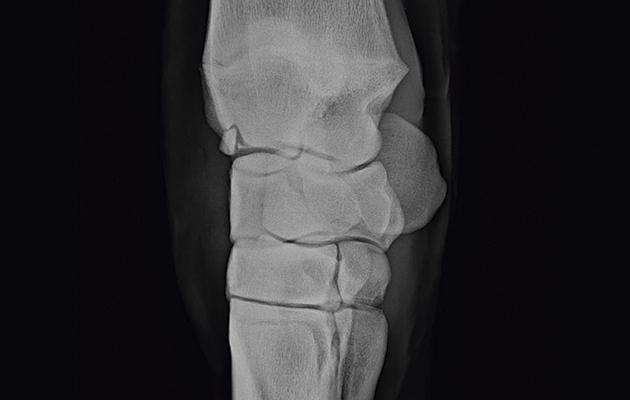 A bone chip in the stifle joint presents as joint distension