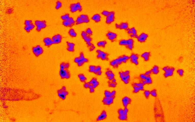 The spread of 46 human chromosomes, with added color.