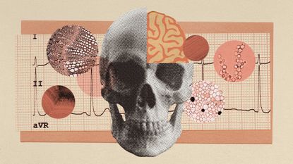 Photo collage of a human skull, an illustration of the brain and an ECG readout