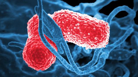 Dangerous Strains Of 'hypervirulent' Superbug Detected In US And 15 ...