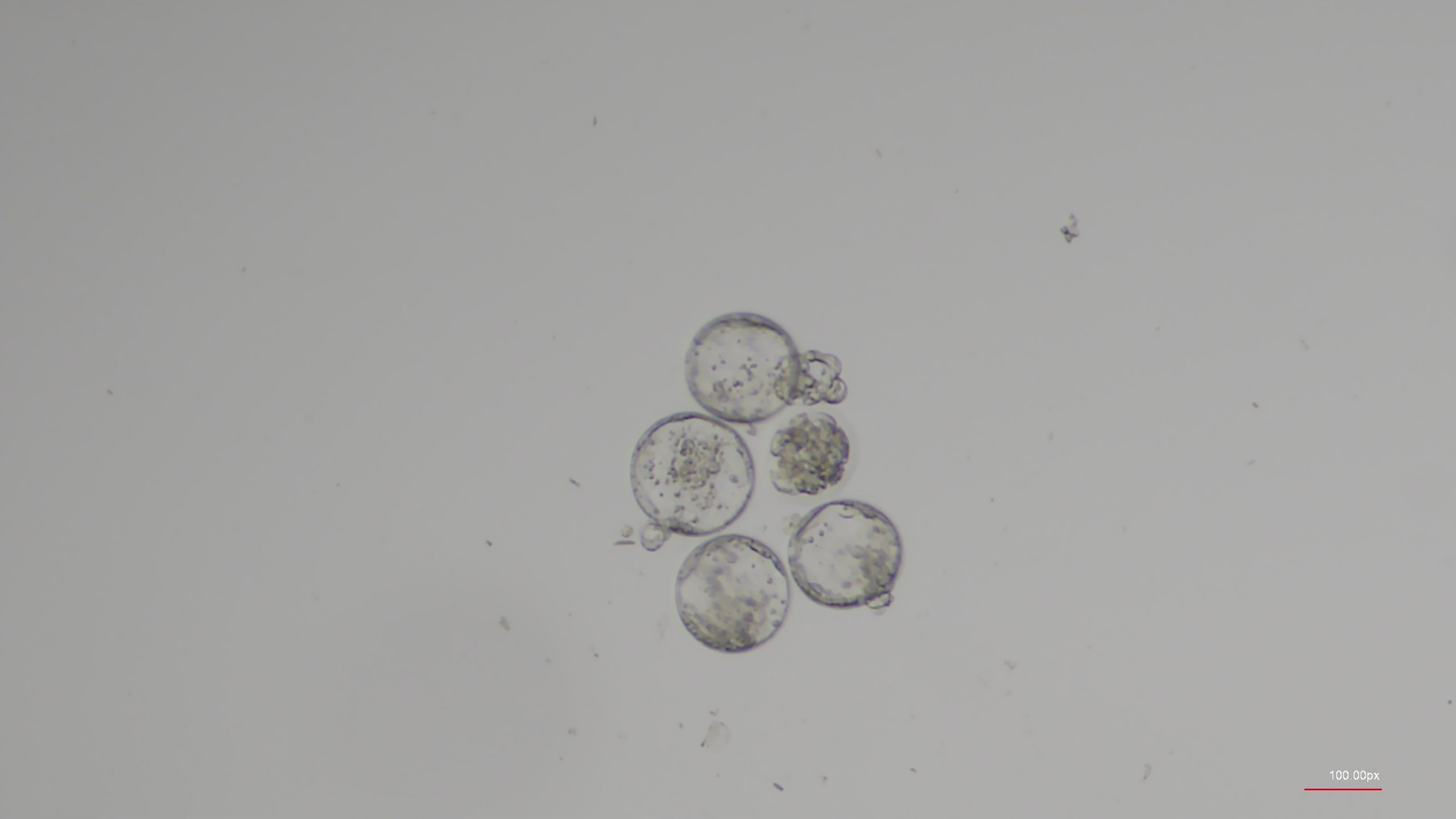 دوائر واضحة على خلفية رمادية.