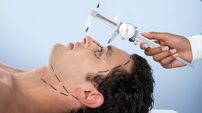 Caliper measuring a patient's nose 