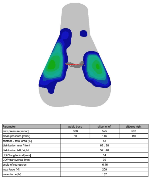 A visual output of saddle pressure mapping