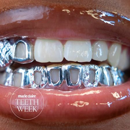 silver grillz
