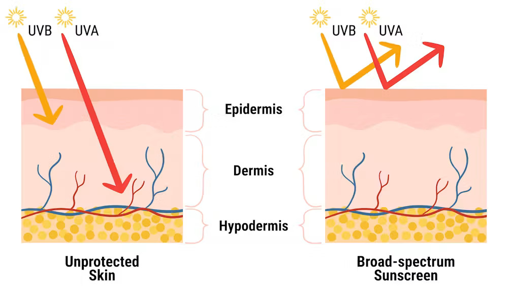 Two images show how sunscreen works, depicting how it deflects UV light from skin