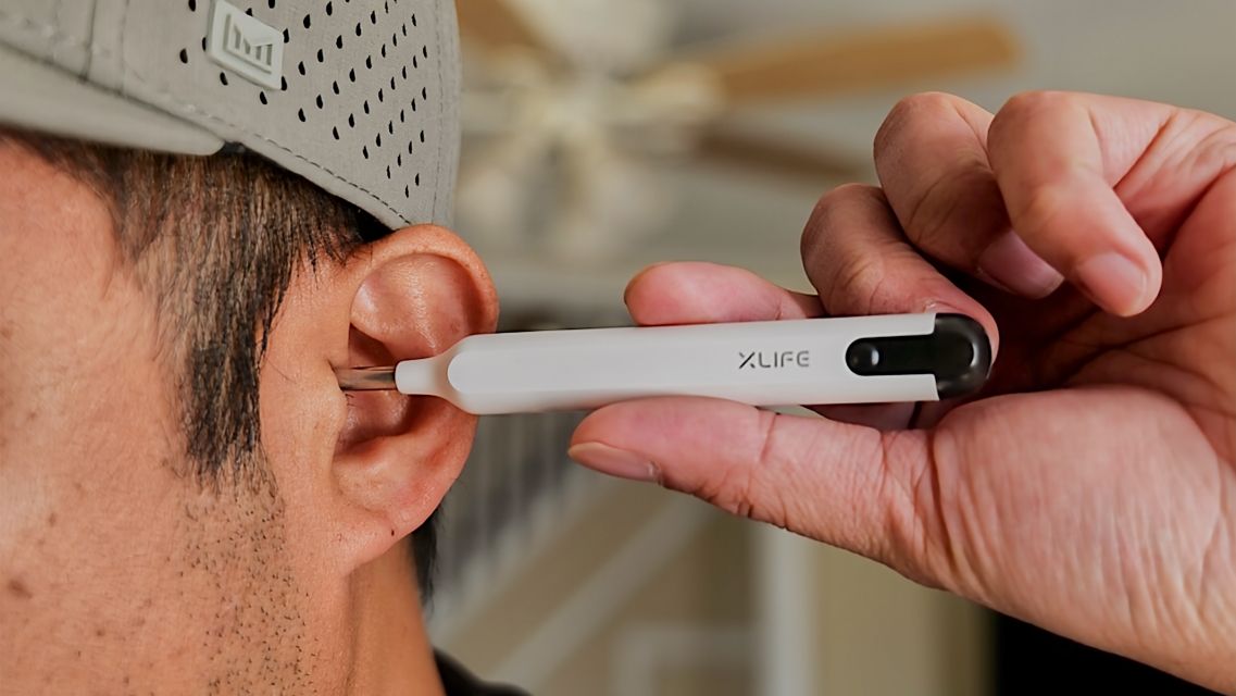 Xlife wireless endoscope camera being used to remove ear wax in ear.