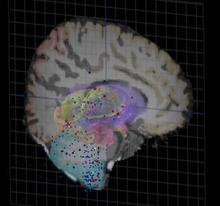 3-D rendering from the Allen Human Brain Atlas