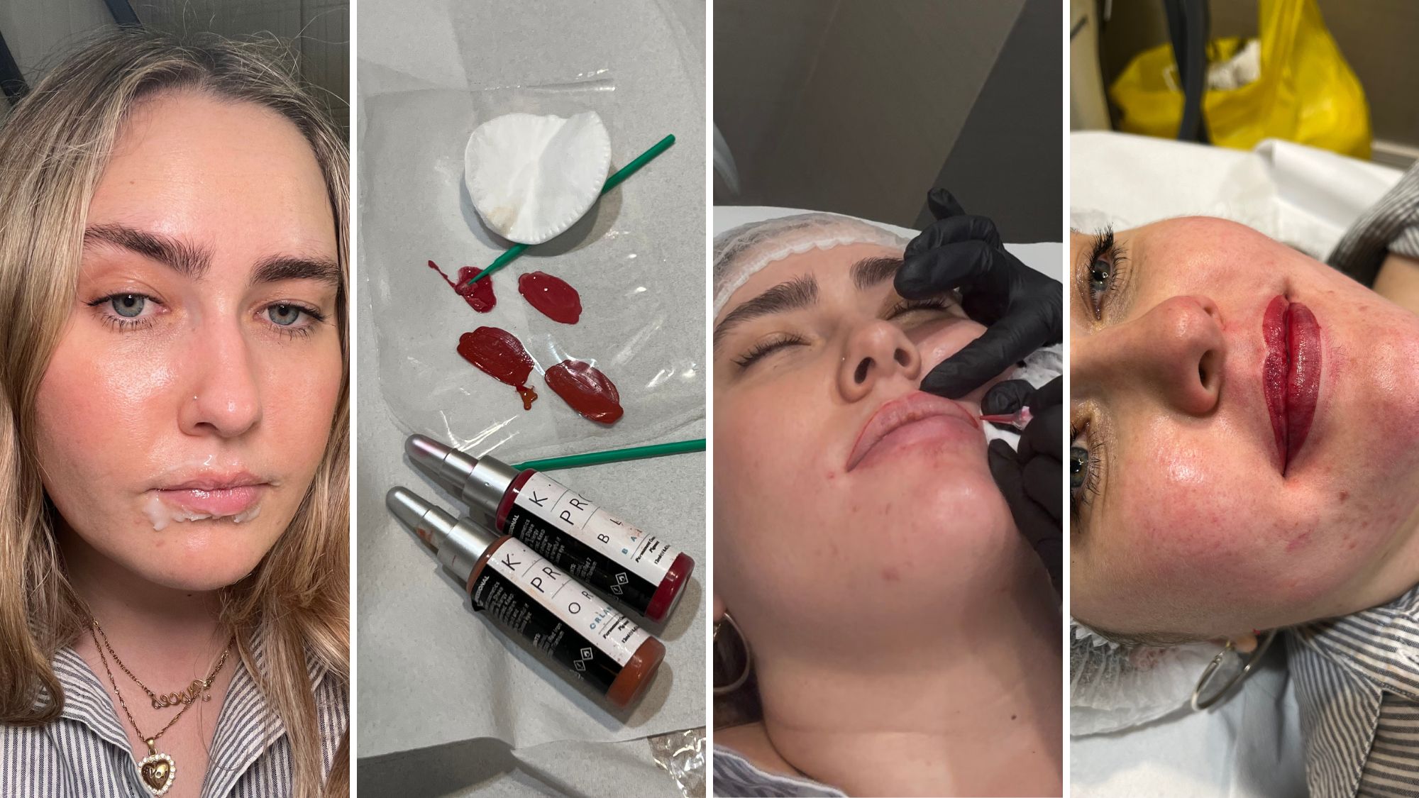 the stages of the lip blush treatment process - start to finish