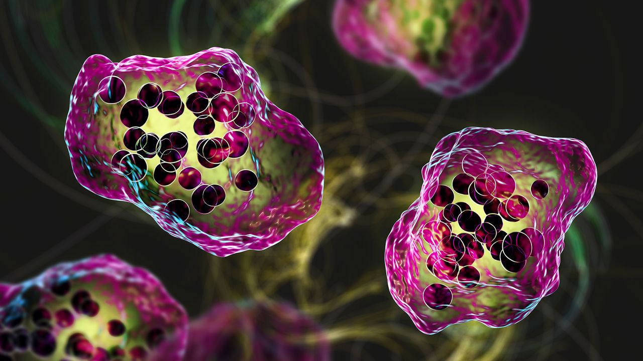  South Carolinas measles outbreak nears 790 cases &mdash; making it the biggest in decades 