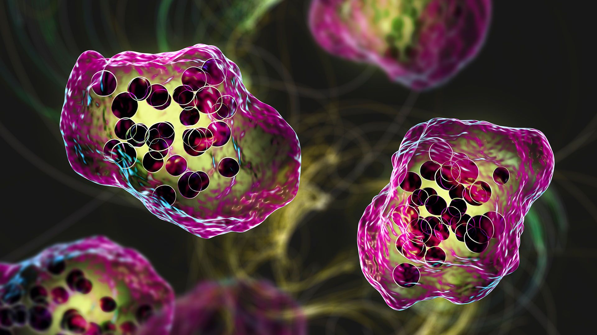 South Carolina’s measles outbreak is the largest since the US eliminated the disease South Carolina’s measles outbreak is the largest since the US eliminated the disease