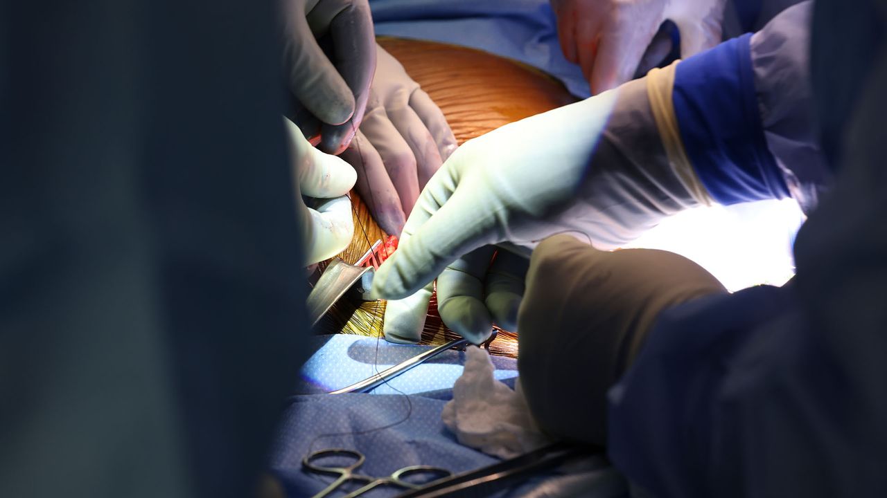 Surgeons perform the world&rsquo;s first genetically modified pig kidney transplant into a living human at Massachusetts General Hospital.